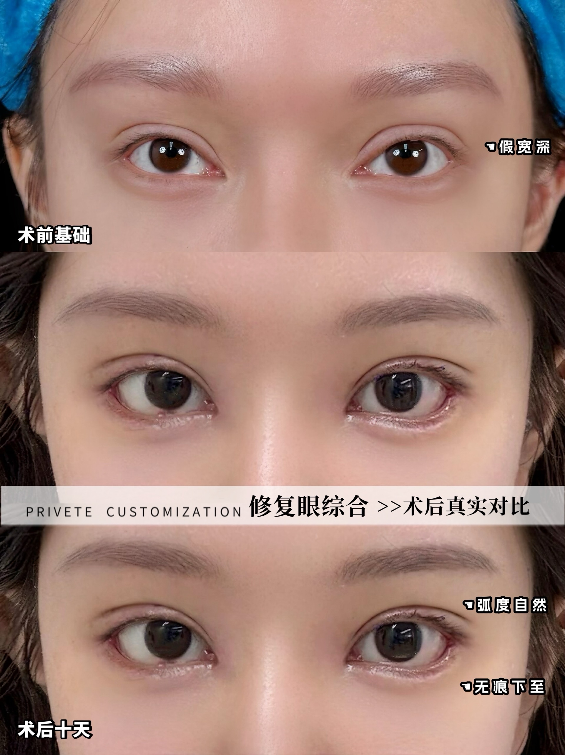 做一个幼态脸多少钱，多少钱可以变好看(图3)