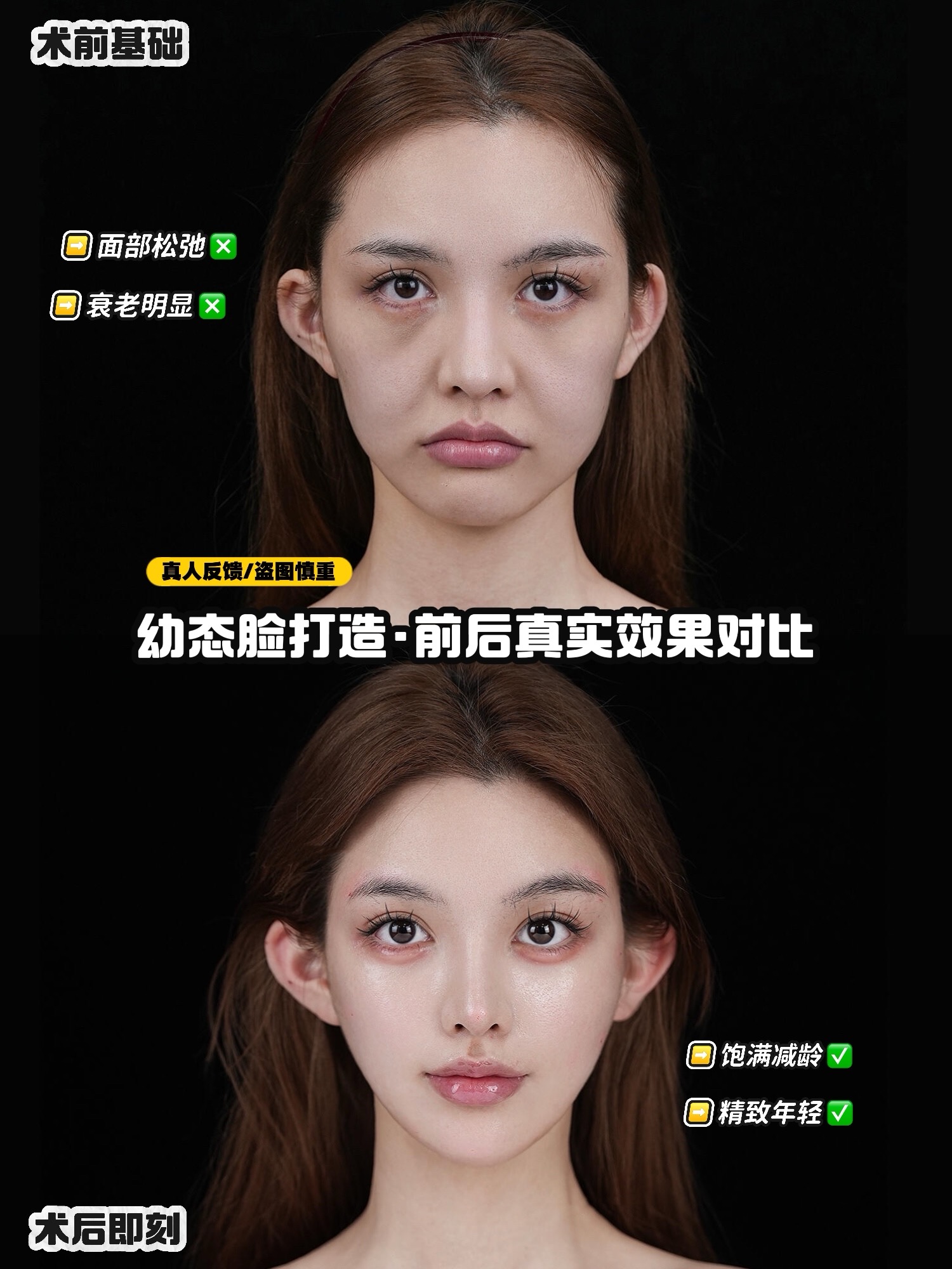 幼态脸越来越受欢迎！普通人怎么微调才能更显幼态(图1)
